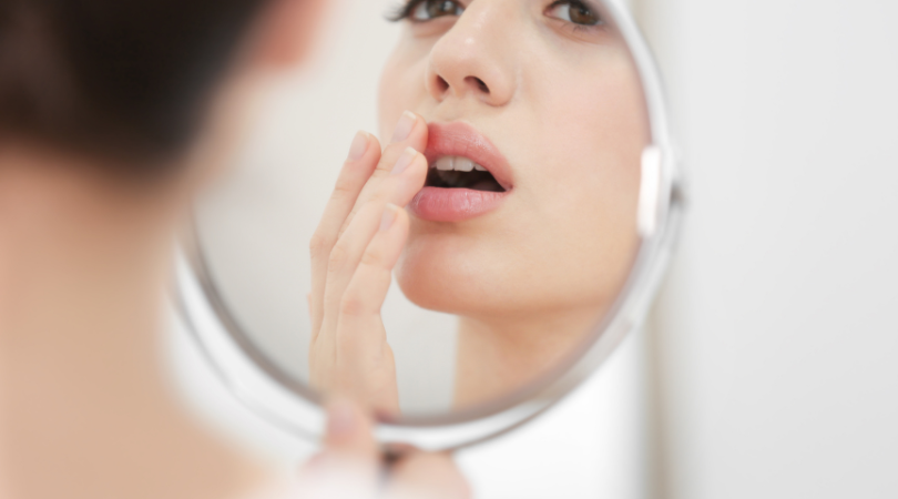The Ultimate Guide to Lysine Lip Balm: Your Natural Solution for Healthy Lips