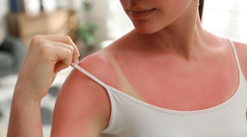 Sunscreen 101: Your Guide to Staying Safe in the Sun